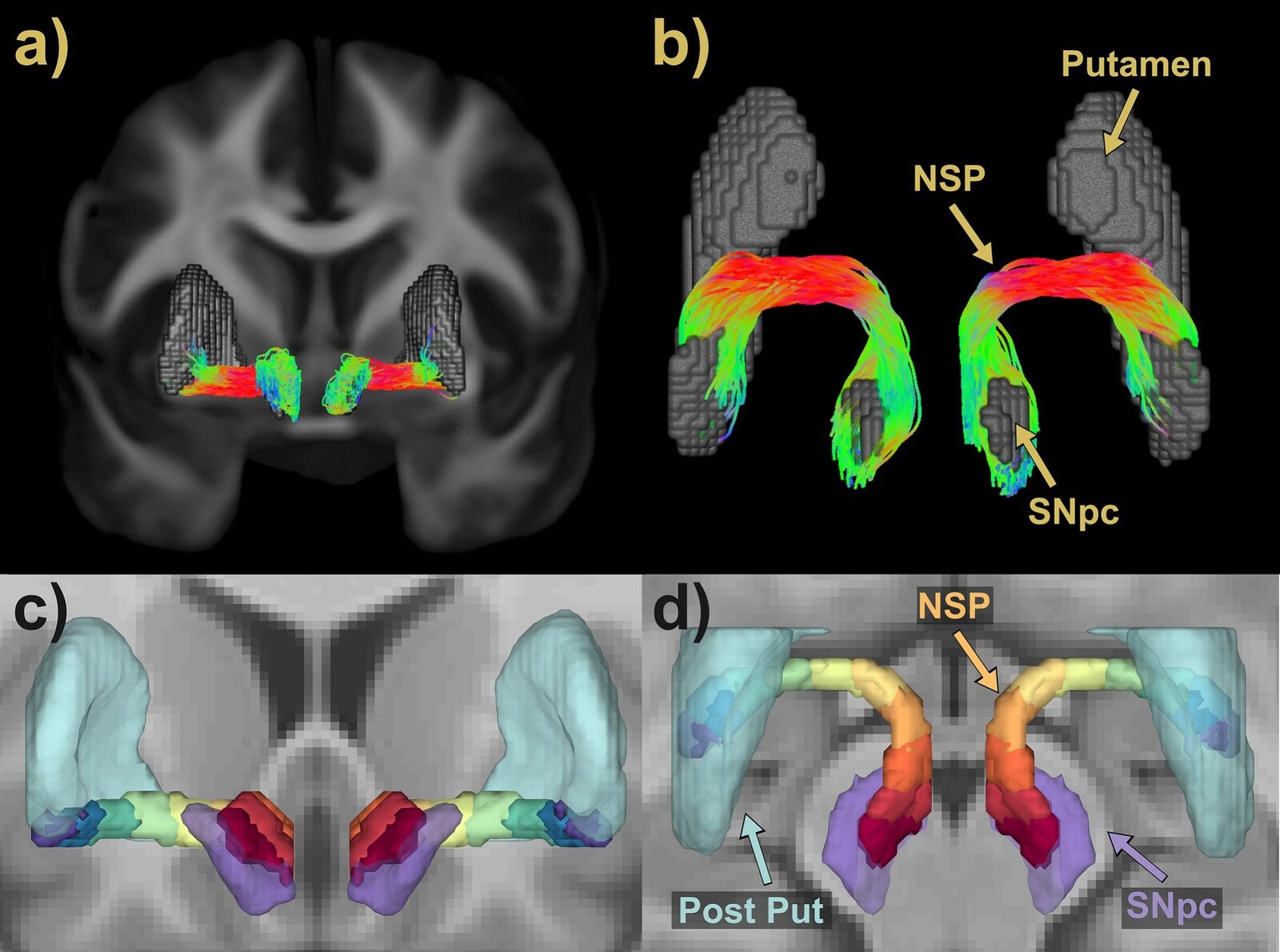 Nigrostriatal pathway tractography