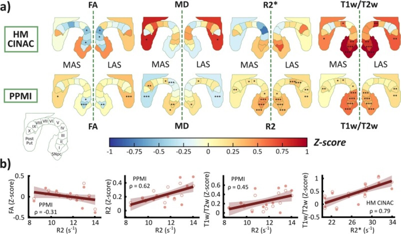 Microstructural findings along the nigrostriatal pathway