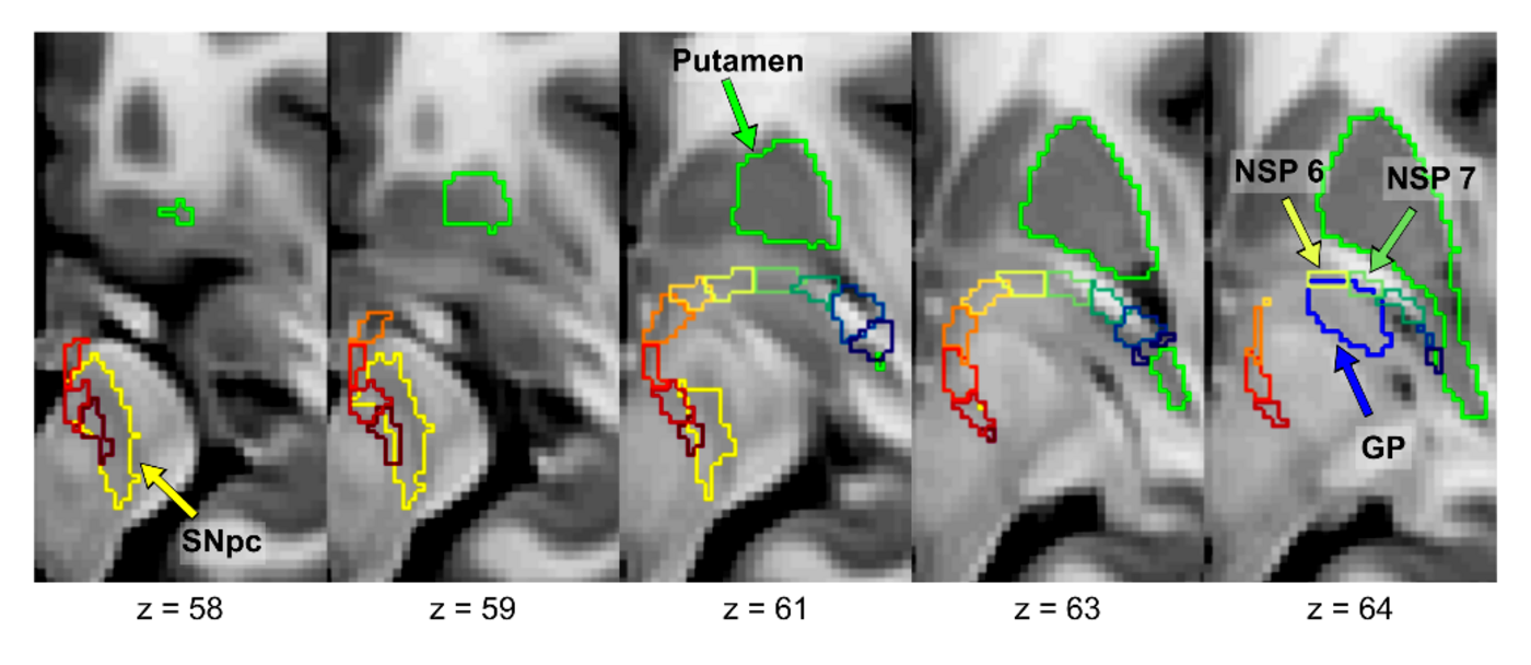Nigrostriatal pathway and its subregions segmented across axial slices